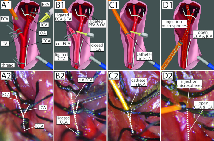 figure-protocol-2 Carotid artery ligation and catheterization process; diagram and surgical setup; vascular surgery.