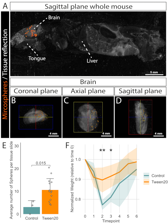 figure-results-1 Sagittal whole mouse image with microsphere distribution, brain plane views, and tissue sphere analysis.