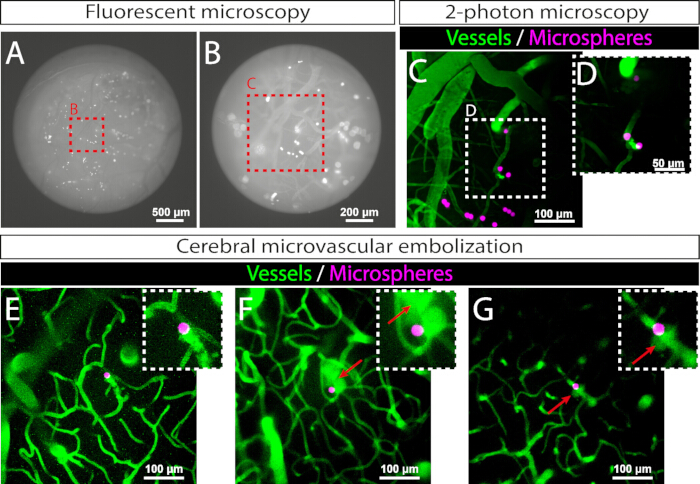 figure-results-2 Fluorescent microscopy showing cerebral microvascular embolization with green vessels, pink microspheres.
