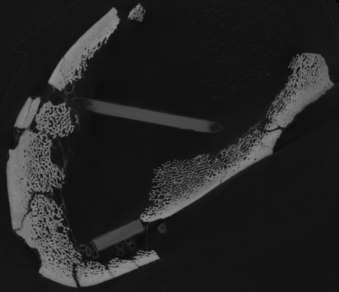 CT scan image, bone density analysis, structural assessment, grayscale imaging technique.