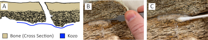Bone repair process: diagram (cross section) and images (adhesive application, restoration technique).