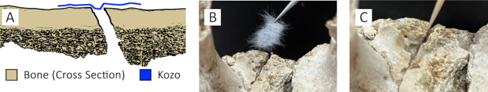 Bone restoration process: A) Diagram; B) Applying Kozo fiber; C) Repair result on bone surface.