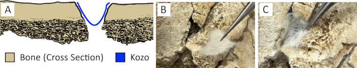 Bone cross-section repair with Kozo application; diagram and microscope images for material study.