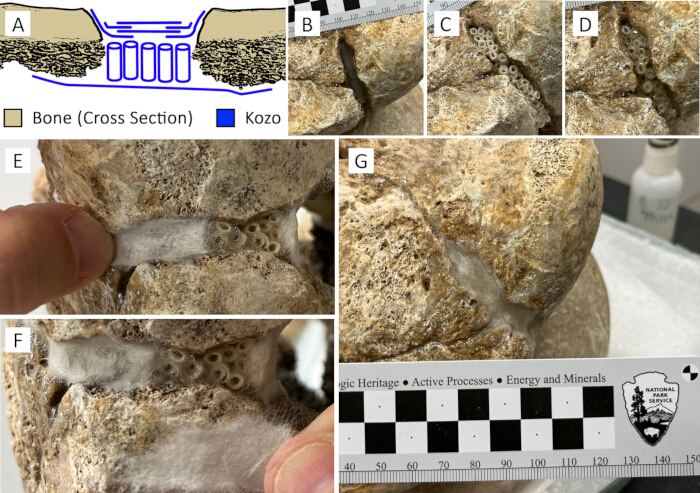 Bone restoration process using Kozo, cross-section diagram, and repair method analysis.
