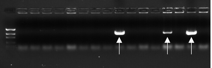 Gel electrophoresis result; DNA separation; bands highlighted; molecular weight markers visible.