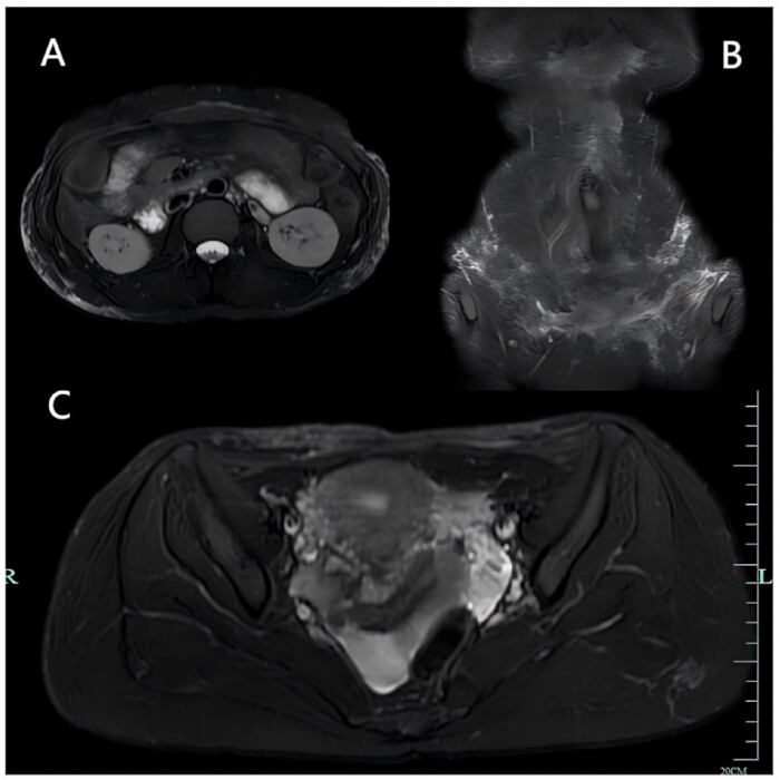 MRI cross-sectional images; abdominal and pelvic anatomy; medical diagnostic imaging.