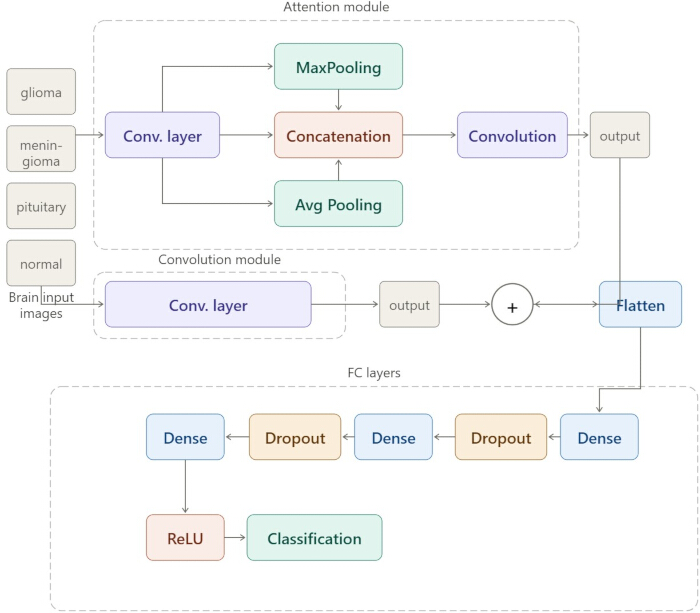 Deep learning model diagram for brain image classification; convolution, pooling, and dense layers.