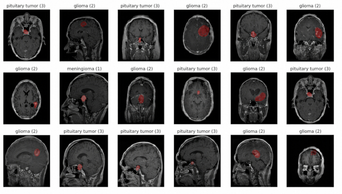 Brain tumor MRI scans; glioma and pituitary tumor identification; medical imaging analysis results.