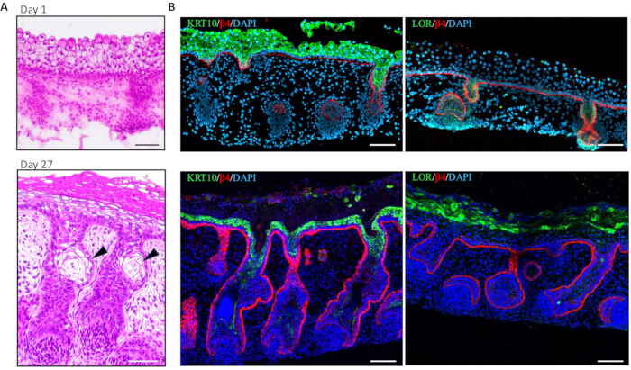 Histology and immunofluorescence images showing epidermal layer changes over 27 days; keratin and loricrin markers.
