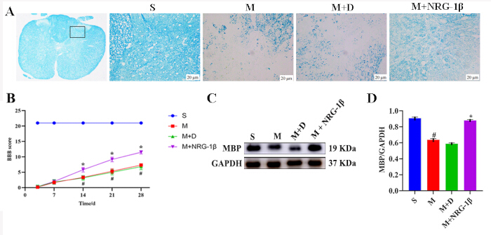 figure-results-5 Histology and protein analysis: brain tissue sections, BBB permeability graph, Western blotting results.