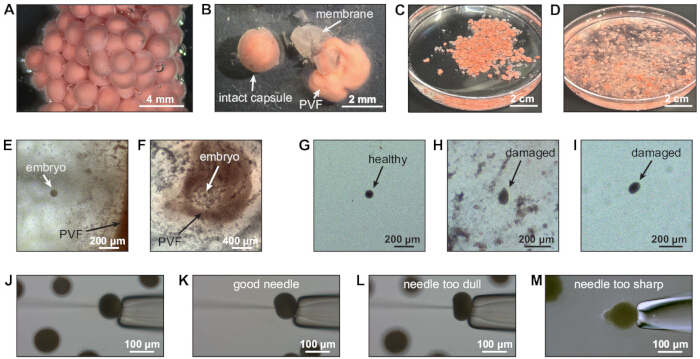 Embryo extraction process; microscopy image; needle assessment for precision in transfer technique.
