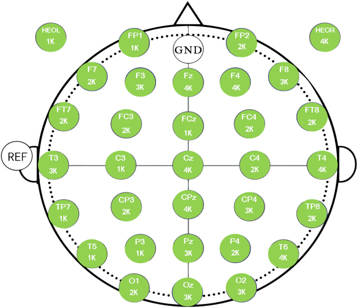 EEG electrode placement diagram illustrating the 10-20 system for brainwave recording setup.