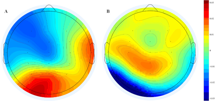 EEG topographical maps; brain activity; comparison; heat map; signal intensity; data analysis.