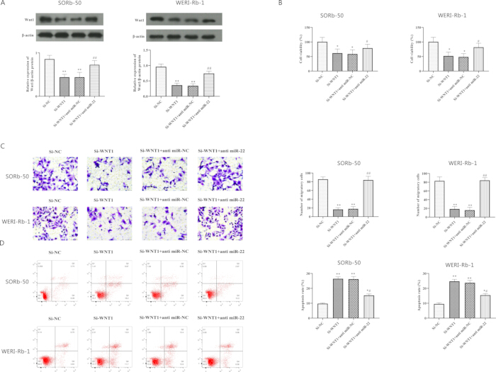 Western blot and bar graph analysis of Wnt1 expression; cell migration assay; apoptosis flow cytometry.