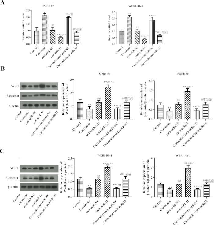 Gene expression analysis, SORD-50 and WERI-Rb-1, protein levels, Western blot, bar graphs comparison.