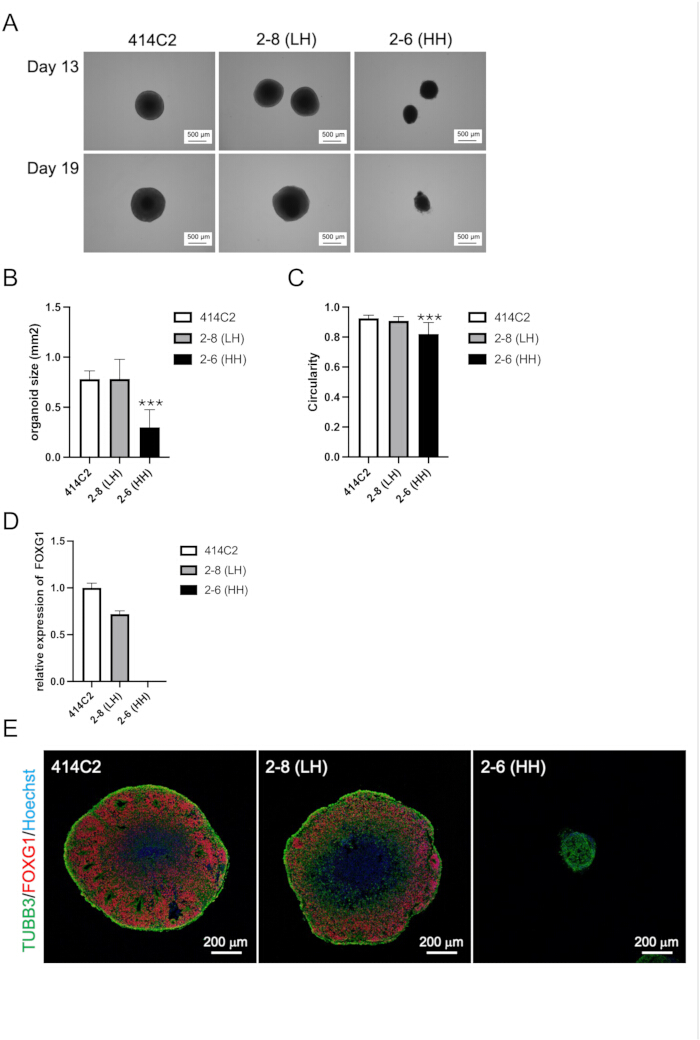 Organoid growth comparison; microscopy images, bar charts, immunofluorescence; FOXG1 expression.
