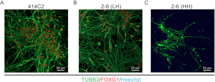 Neuronal differentiation, fluorescence microscopy, TUBB3/FOXG1 markers, neural cell growth analysis.
