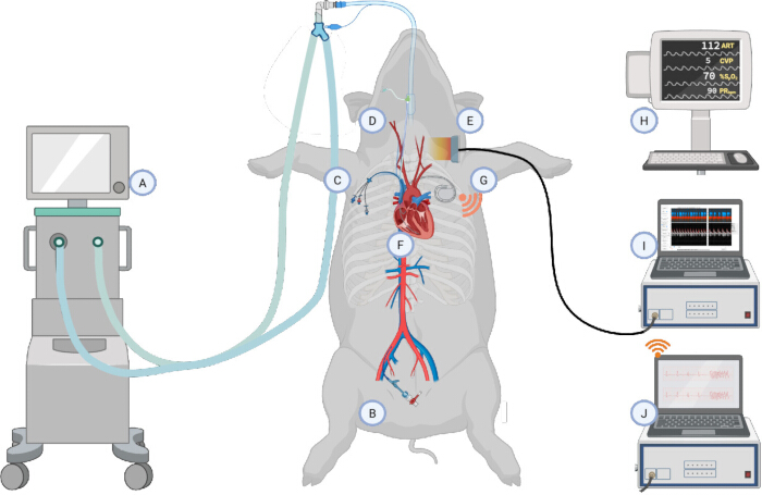 Cardiopulmonary bypass surgery diagram; equipment for heart-lung machine monitoring and data analysis.
