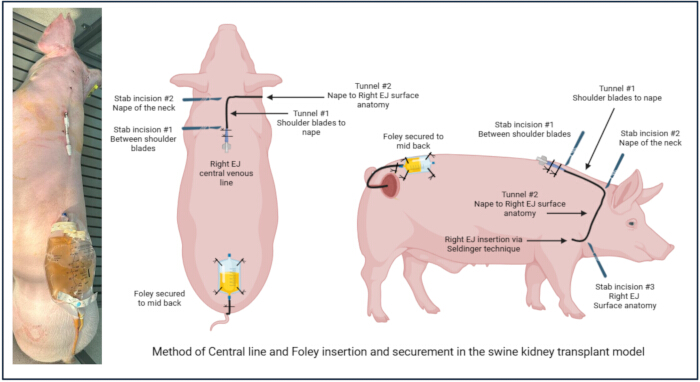Swine kidney transplant model; central line, Foley insertion; diagram detailing surgical procedure.