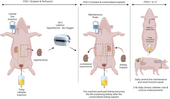 Kidney transplantation process diagram in pigs with central line, nephrectomy, fluid maintenance setup.