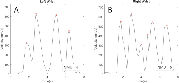Velocity vs. Time graph, left/right wrist, NMU=4/6, motion analysis, wrist movement study.