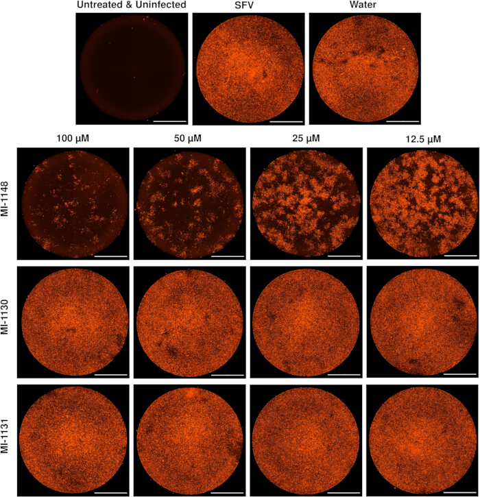 figure-results-4 Microscopy image of SFV-infected cell cultures at varying concentrations, showing infection levels.