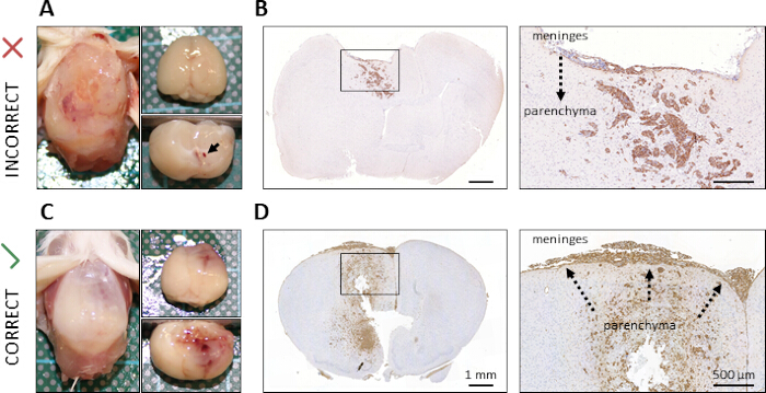 figure-results-3 Mouse brain dissection; meninges and parenchyma; histology comparison; magnified tissue sections.