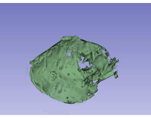 figure-protocol-3 Figura 3