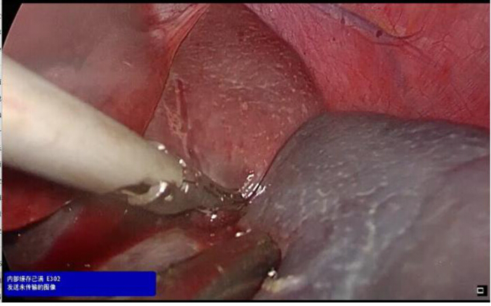 Surgical procedure, endoscopic image, internal examination, medical equipment, minimally invasive.