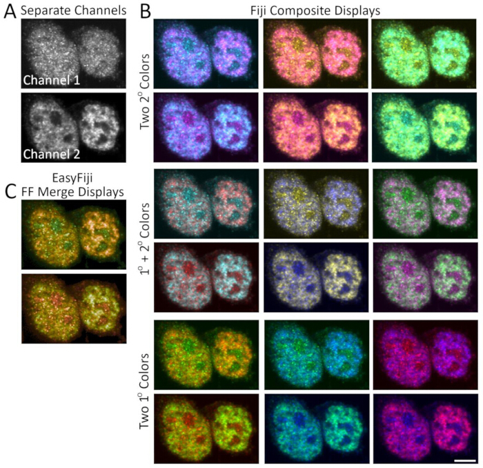 figure-results-2 Microscopy display: separate channels, Fiji composite visualizations, EasyFiji FF merge results.
