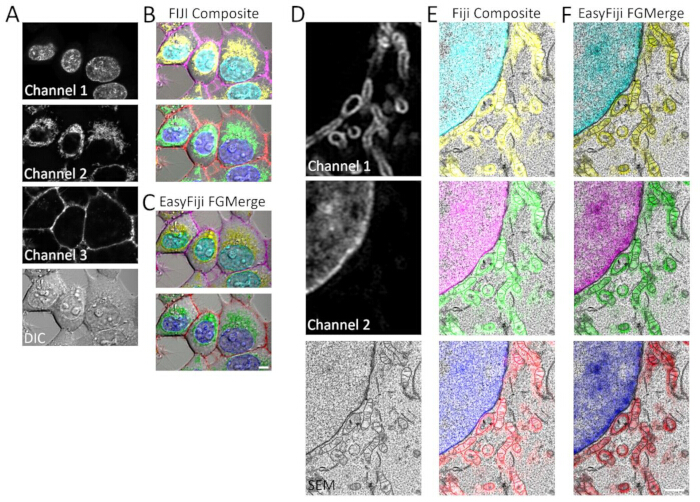 figure-results-4 Microscopy image analysis with channel separation and color composite in Fiji, SEM detail view.