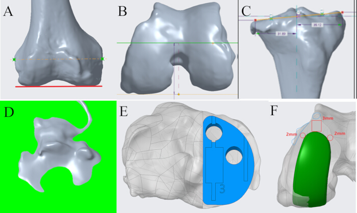Knee joint modeling diagram; bone structure analysis; 3D visualization for orthopedic research.