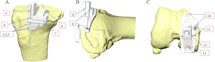 Shoulder joint anatomical diagram with labeled components for orthopedic study.
