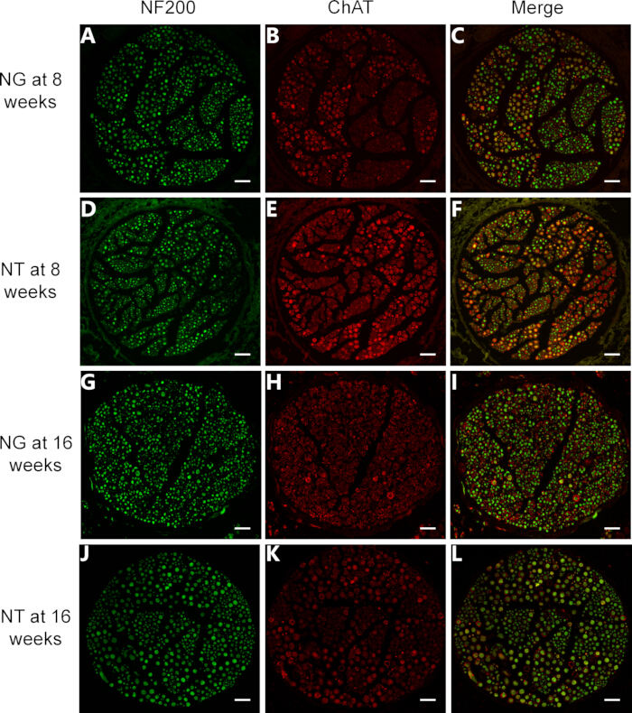 Neural fluorescence microscopy images, NF200 ChAT protein expression, 8-16 weeks, merged overlay.