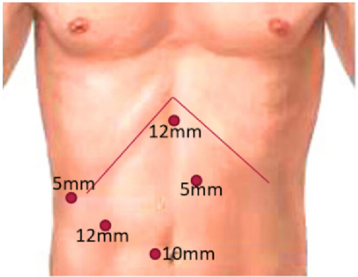 Şekil 1