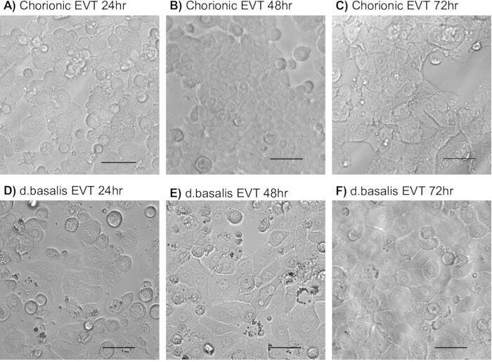 figure-results-2 Chorionic and d.basalis EVT microscopy images showing cellular changes over 24-72 hours for cell analysis.