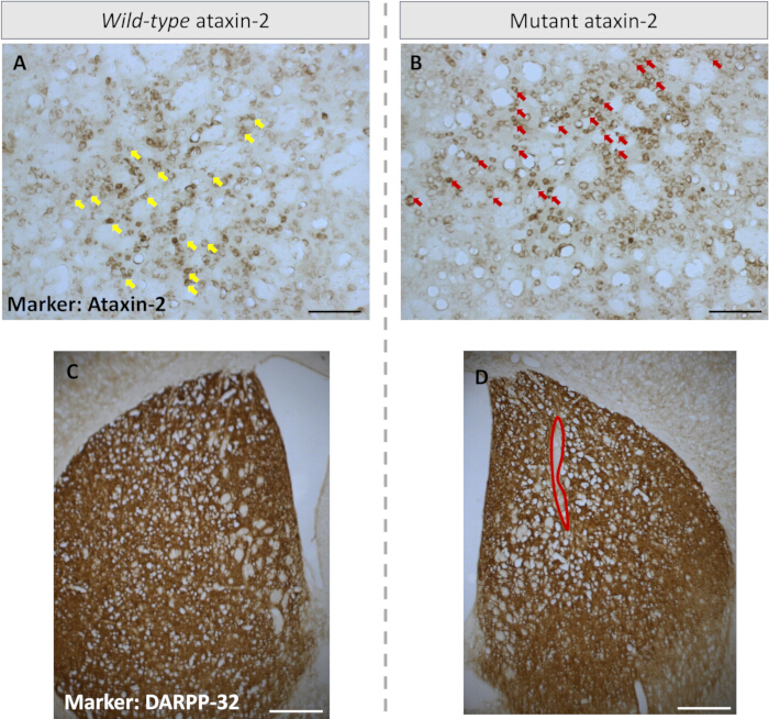 Wild-type vs mutant ataxin-2 comparison; histology images indicate protein expression with markers.