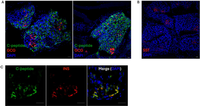figure-results-4 Immunofluorescence images; C-peptide, GCG, SST, INS detection; cellular analysis; microscopy.