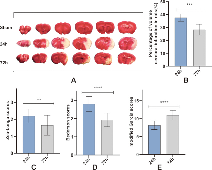 Rat cerebral infarction analysis; TTC staining, graph of infarct volume, line charts of scores.
