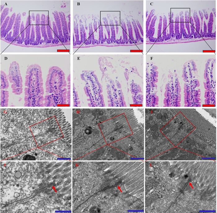 Histological and electron microscopy comparison of intestinal villi and ultrastructure.