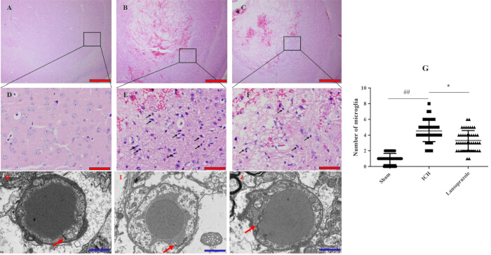 Histology analysis of brain tissues with microglia count, microscopy images, and comparative graph.