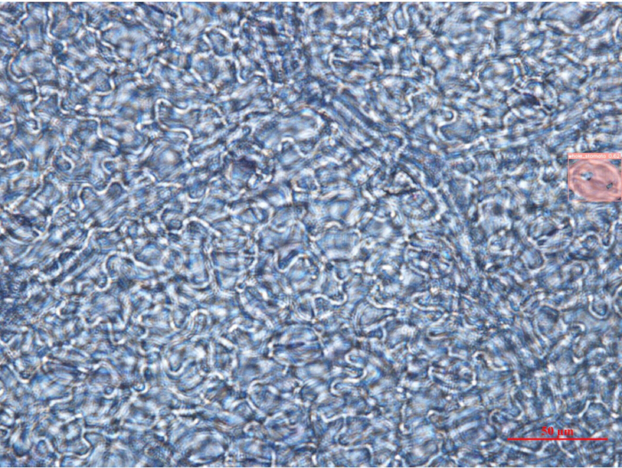 figure-results-7 Microscopy image of plant leaf epidermis cells, showing cell wall patterns and stomatal structure.