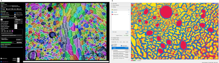 figure-results-9 Cellular segmentation analysis; microscopy image showing colored cell boundaries and software interface.