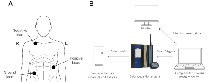 figure-introduction-1 ECG setup diagram: lead placement and data acquisition for cardiac signal analysis.