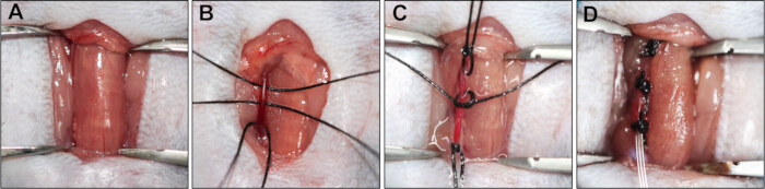 figure-results-3 Surgical technique diagram: suture placement and tissue tension in wound closure steps A-D.