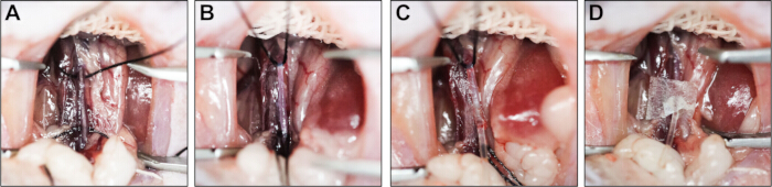 figure-results-5 Sequential surgical process, suturing method, oral cavity, tissue reconstruction steps.