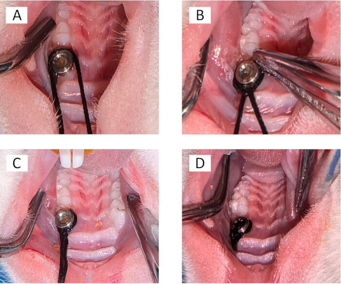 Oral surgery procedure images, sequence A-D; dental tools; surgical technique demonstration.