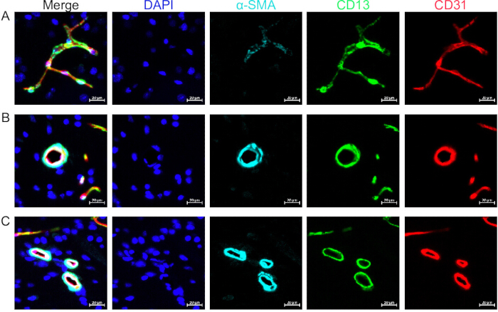 figure-introduction-1 Immunofluorescence cell analysis, DAPI, α-SMA, CD13, CD31 labeling; confocal microscopy results.
