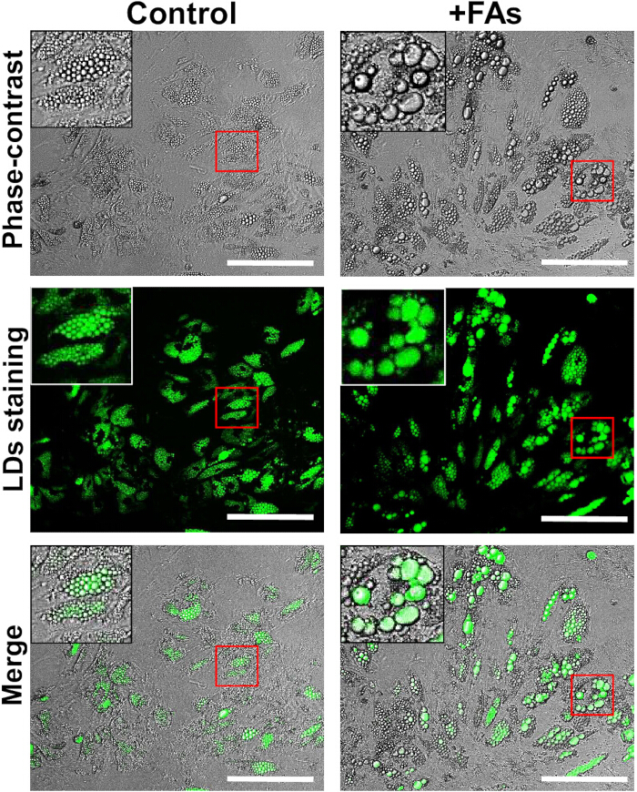 Differentiation and Induction of Lipid Droplet Accumulation in Human ...