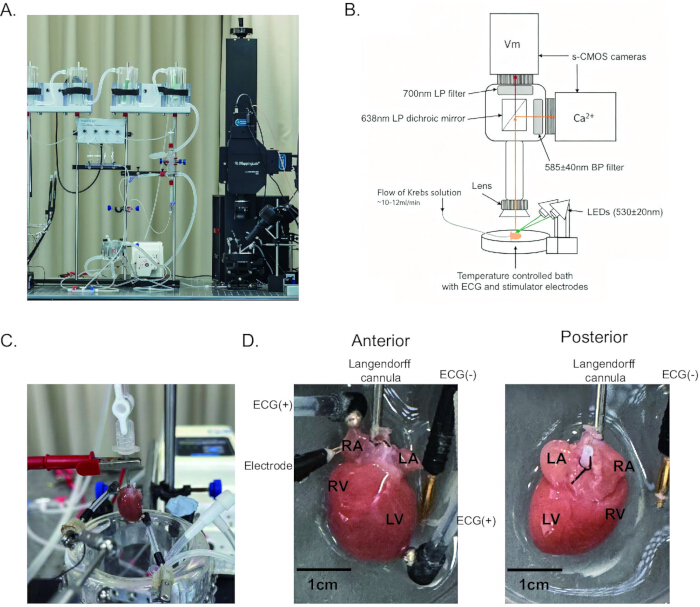 figure-results-1 Langendorff heart setup with Krebs solution; Ca²⁺ imaging system; electrode placement diagram.